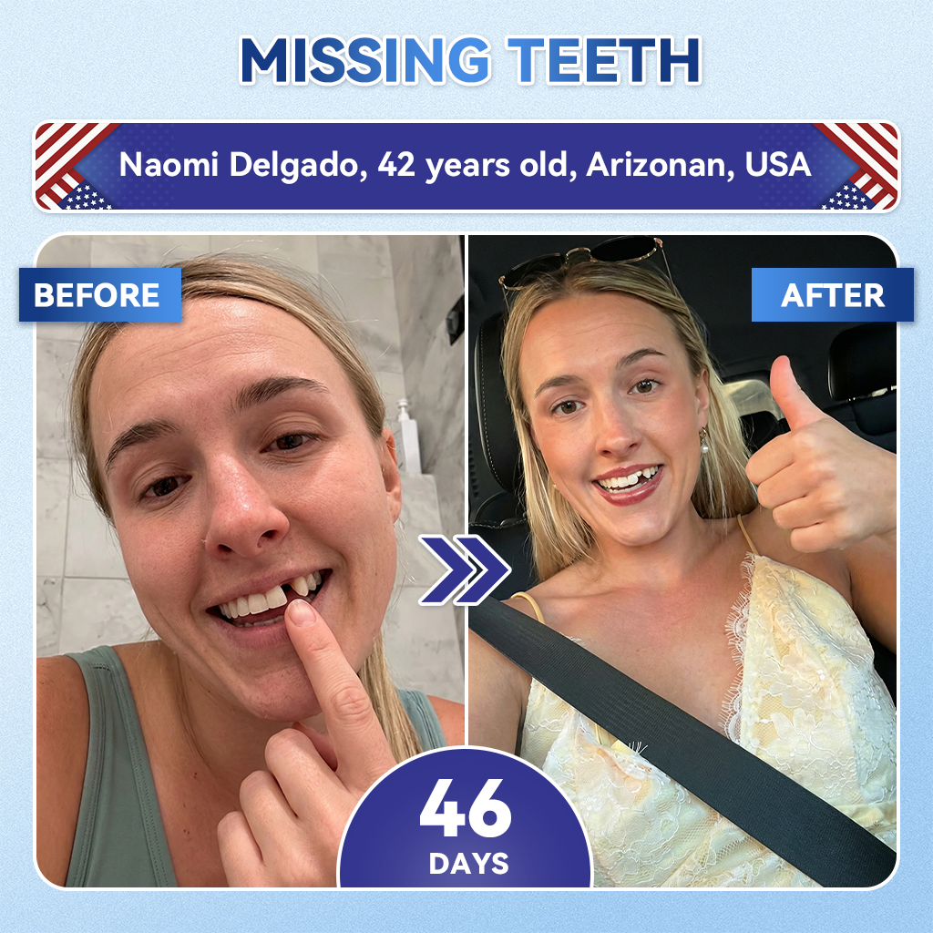 Your Smile~ Natravorยฎ ๐ฆท Tideglusib FastโDissolving Tooth & Gum Repair Oral Strips โจ (๐-๐ข๐ง-๐ ๐ ๐๐๐๐ฎ๐ข๐ฅ๐ ๐๐ง๐๐ฆ๐๐ฅ & ๐๐๐ง๐ญ๐ข๐ง โข ๐๐ญ๐ซ๐๐ง๐ ๐ญ๐ก๐๐ง ๐๐ฎ๐ฆ๐ฌ โข ๐๐ซ๐๐๐ข๐๐๐ญ๐ ๐๐๐ซ๐ญ๐๐ซ & ๐๐๐จ๐ซ โข ๐๐ก๐ข๐ญ๐๐ง๐ข๐ง๐ โข ๐๐ญ๐จ๐ฉ ๐๐จ๐จ๐ญ๐ก ๐๐๐ง๐ฌ๐ข๐ญ๐ข๐ฏ๐ข๐ญ๐ฒ)