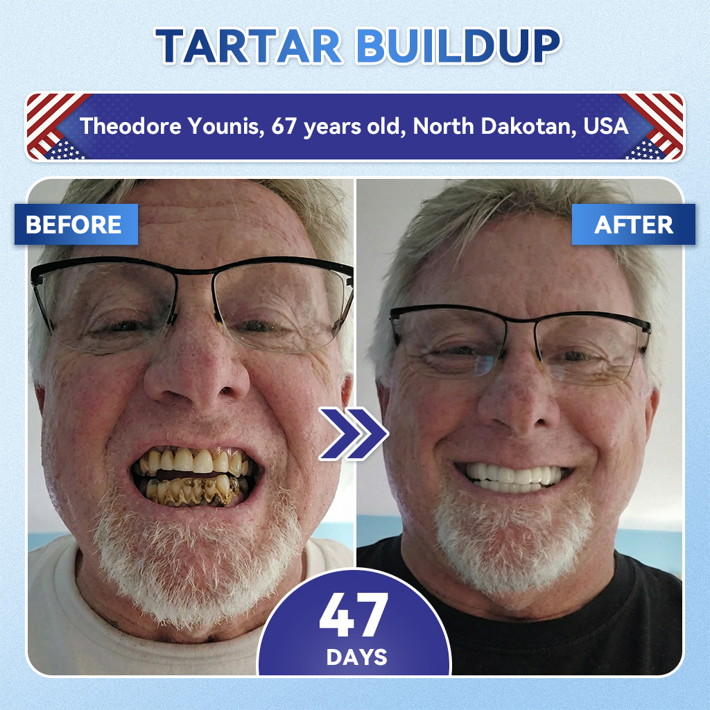 Your Smile~ Natravor® 🦷 Tideglusib Fast‑Dissolving Tooth & Gum Repair Oral Strips ✨ (𝟓-𝐢𝐧-𝟏 💎 𝐑𝐞𝐛𝐮𝐢𝐥𝐝 𝐄𝐧𝐚𝐦𝐞𝐥 & 𝐃𝐞𝐧𝐭𝐢𝐧 • 𝐒𝐭𝐫𝐞𝐧𝐠𝐭𝐡𝐞𝐧 𝐆𝐮𝐦𝐬 • 𝐄𝐫𝐚𝐝𝐢𝐜𝐚𝐭𝐞 𝐓𝐚𝐫𝐭𝐚𝐫 & 𝐎𝐝𝐨𝐫 • 𝐖𝐡𝐢𝐭𝐞𝐧𝐢𝐧𝐠 • 𝐒𝐭𝐨𝐩 𝐓𝐨𝐨𝐭𝐡 𝐒𝐞𝐧𝐬𝐢𝐭𝐢𝐯𝐢𝐭𝐲)