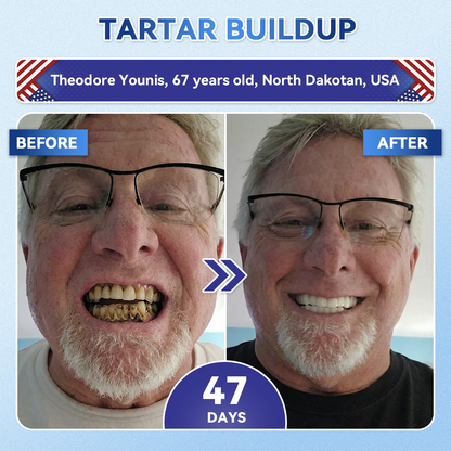 Your Smile~ Natravor® 🦷 Tideglusib Fast‑Dissolving Tooth & Gum Repair Oral Strips ✨ (𝟓-𝐢𝐧-𝟏 💎 𝐑𝐞𝐛𝐮𝐢𝐥𝐝 𝐄𝐧𝐚𝐦𝐞𝐥 & 𝐃𝐞𝐧𝐭𝐢𝐧 • 𝐒𝐭𝐫𝐞𝐧𝐠𝐭𝐡𝐞𝐧 𝐆𝐮𝐦𝐬 • 𝐄𝐫𝐚𝐝𝐢𝐜𝐚𝐭𝐞 𝐓𝐚𝐫𝐭𝐚𝐫 & 𝐎𝐝𝐨𝐫 • 𝐖𝐡𝐢𝐭𝐞𝐧𝐢𝐧𝐠 • 𝐒𝐭𝐨𝐩 𝐓𝐨𝐨𝐭𝐡 𝐒𝐞𝐧𝐬𝐢𝐭𝐢𝐯𝐢𝐭𝐲)