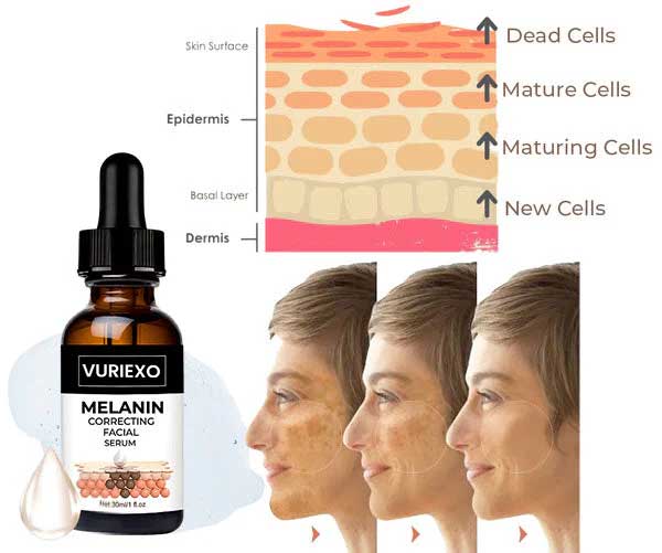 ✨Fast Dark Spot Remover-vuriexo™  Melanin Correcting Facial Serum(🔥Last Day Promotion 60% OFF)