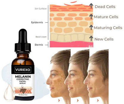 ✨Fast Dark Spot Remover-vuriexo™  Melanin Correcting Facial Serum(🔥Last Day Promotion 60% OFF)
