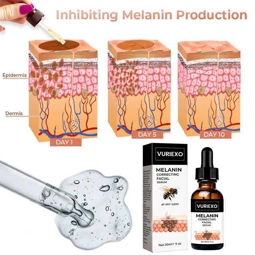 ✨Fast Dark Spot Remover-vuriexo™  Melanin Correcting Facial Serum(🔥Last Day Promotion 60% OFF)