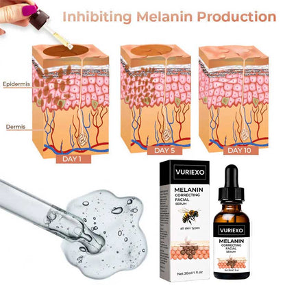 ✨Fast Dark Spot Remover-vuriexo™  Melanin Correcting Facial Serum(🔥Last Day Promotion 60% OFF)