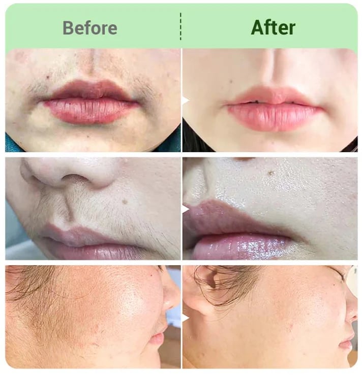 Hair RemovalCream for All Women &Men