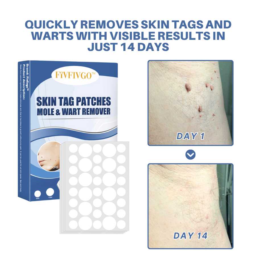 Fivfivgo® Moles & Warts Removing Skin Tag Patch