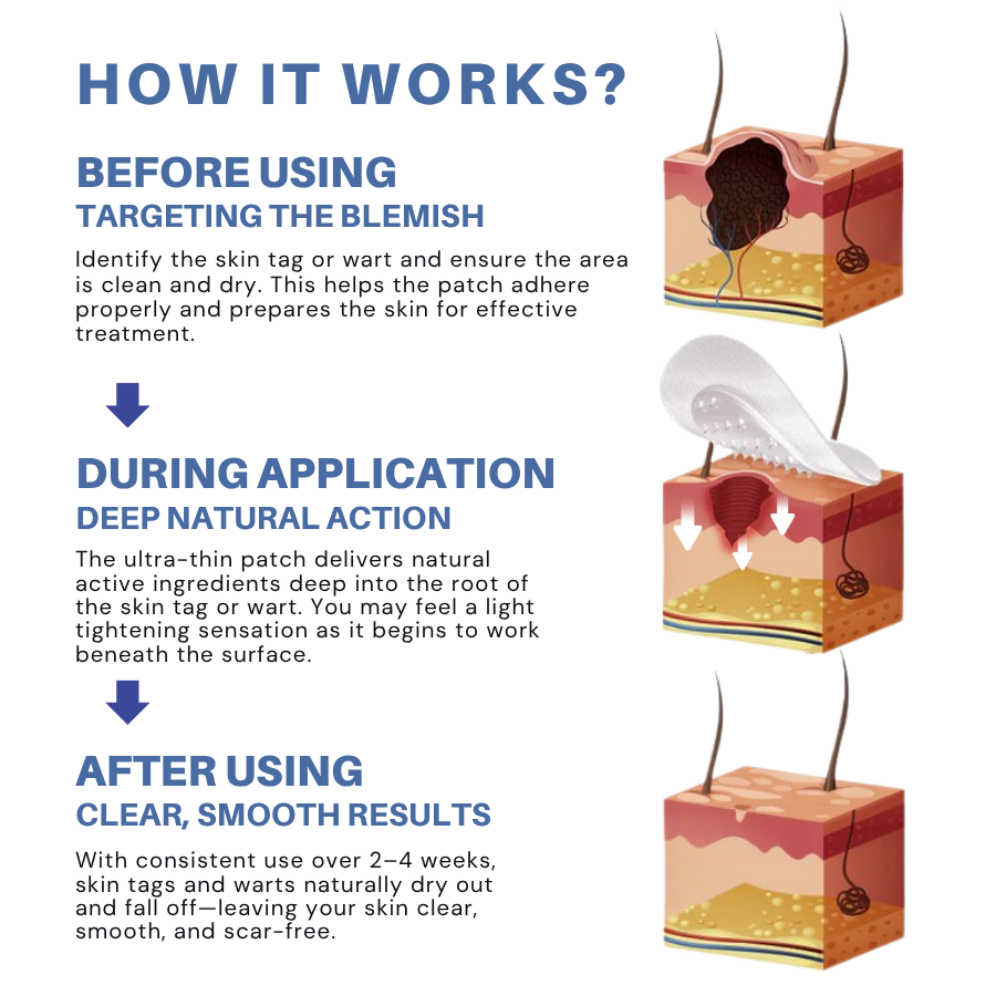 Fivfivgo® Moles & Warts Removing Skin Tag Patch