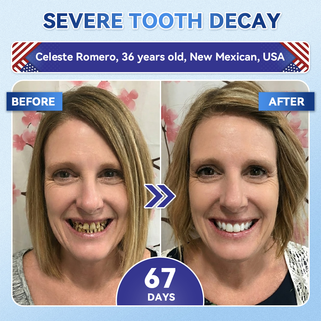 Your Smile~ Natravor® 🦷 Tideglusib Fast‑Dissolving Tooth & Gum Repair Oral Strips ✨ (𝟓-𝐢𝐧-𝟏 💎 𝐑𝐞𝐛𝐮𝐢𝐥𝐝 𝐄𝐧𝐚𝐦𝐞𝐥 & 𝐃𝐞𝐧𝐭𝐢𝐧 • 𝐒𝐭𝐫𝐞𝐧𝐠𝐭𝐡𝐞𝐧 𝐆𝐮𝐦𝐬 • 𝐄𝐫𝐚𝐝𝐢𝐜𝐚𝐭𝐞 𝐓𝐚𝐫𝐭𝐚𝐫 & 𝐎𝐝𝐨𝐫 • 𝐖𝐡𝐢𝐭𝐞𝐧𝐢𝐧𝐠 • 𝐒𝐭𝐨𝐩 𝐓𝐨𝐨𝐭𝐡 𝐒𝐞𝐧𝐬𝐢𝐭𝐢𝐯𝐢𝐭𝐲)
