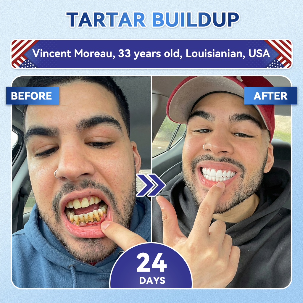 Your Smile~ Natravor® 🦷 Tideglusib Fast‑Dissolving Tooth & Gum Repair Oral Strips ✨ (𝟓-𝐢𝐧-𝟏 💎 𝐑𝐞𝐛𝐮𝐢𝐥𝐝 𝐄𝐧𝐚𝐦𝐞𝐥 & 𝐃𝐞𝐧𝐭𝐢𝐧 • 𝐒𝐭𝐫𝐞𝐧𝐠𝐭𝐡𝐞𝐧 𝐆𝐮𝐦𝐬 • 𝐄𝐫𝐚𝐝𝐢𝐜𝐚𝐭𝐞 𝐓𝐚𝐫𝐭𝐚𝐫 & 𝐎𝐝𝐨𝐫 • 𝐖𝐡𝐢𝐭𝐞𝐧𝐢𝐧𝐠 • 𝐒𝐭𝐨𝐩 𝐓𝐨𝐨𝐭𝐡 𝐒𝐞𝐧𝐬𝐢𝐭𝐢𝐯𝐢𝐭𝐲)