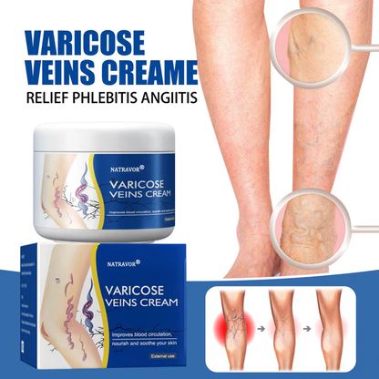 Leg Relief Varicose Veins Cream 50g – Soothing Lotion for Pain, Swelling & Circulation