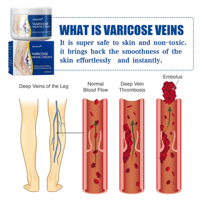 Leg Relief Varicose Veins Cream 50g – Soothing Lotion for Pain, Swelling & Circulation