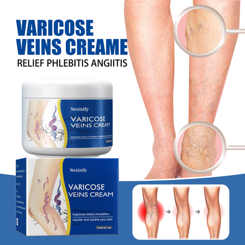 Leg Relief Varicose Veins Cream 50g – Soothing Lotion for Pain, Swelling & Circulation