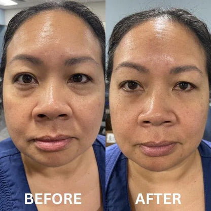 InstantFirm Eye Patches | 1+1 FREE