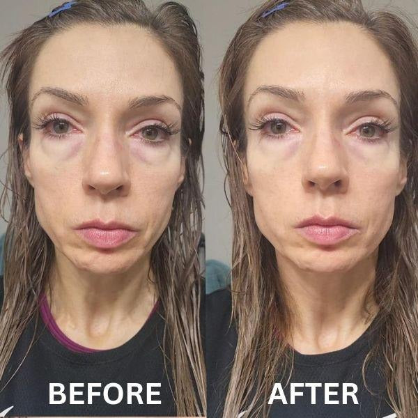 InstantFirm Eye Patches | 1+1 FREE