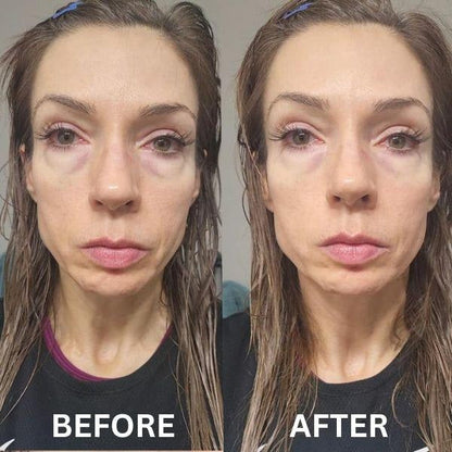 InstantFirm Eye Patches | 1+1 FREE